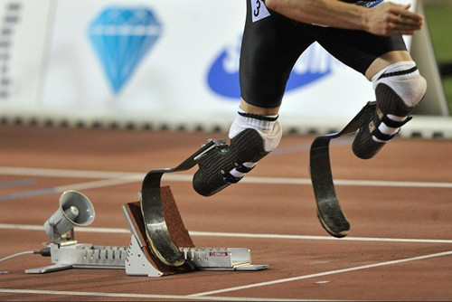 市場(chǎng)一般假肢價(jià)格是在多少呢(圖1) 市場(chǎng)一般假肢價(jià)格是在多少呢(圖1)