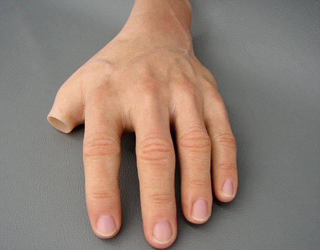 河南安裝假肢好的醫(yī)院在哪力康假肢怎么樣呢(圖1) 河南安裝假肢好的醫(yī)院在哪力康假肢怎么樣呢(圖1)