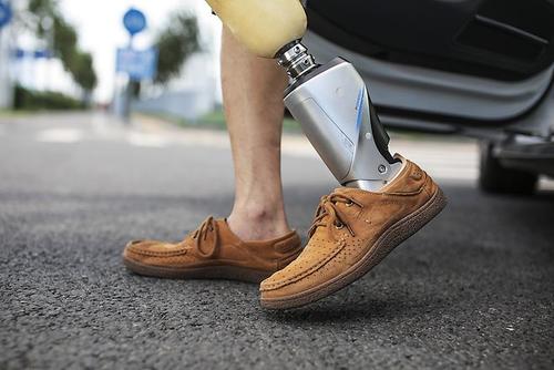 安裝一個(gè)假肢大概需要多少錢(qián)鄭州力康假肢廠家(圖1)