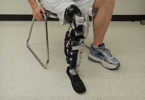 穿戴假肢過程中出現疼痛是怎么回事鄭州力康假肢廠家(圖1) 穿戴假肢過程中出現疼痛是怎么回事鄭州力康假肢廠家(圖1)