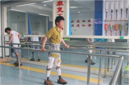 假肢怎么康復呢(圖1) 假肢怎么康復呢